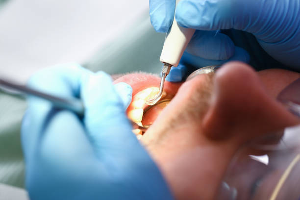 Best Emergency Treatment for Oral Infections in West Hills, PA